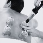 img-services-cupping-therapy.jpg